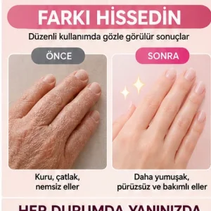 EL BAKIM ELDİVENİ