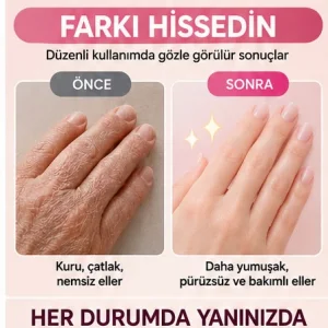 EL BAKIM ELDİVENİ