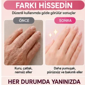 EL BAKIM ELDİVENİ